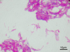 Property for sale by Auction A microscopic image showing clusters of pink-stained rod-shaped bacteria on a pale background. The bacteria appear in various sizes and densities, with some areas more concentrated than others. A scale bar at the bottom right indicates 10 micrometers. Presented by World of Auctions